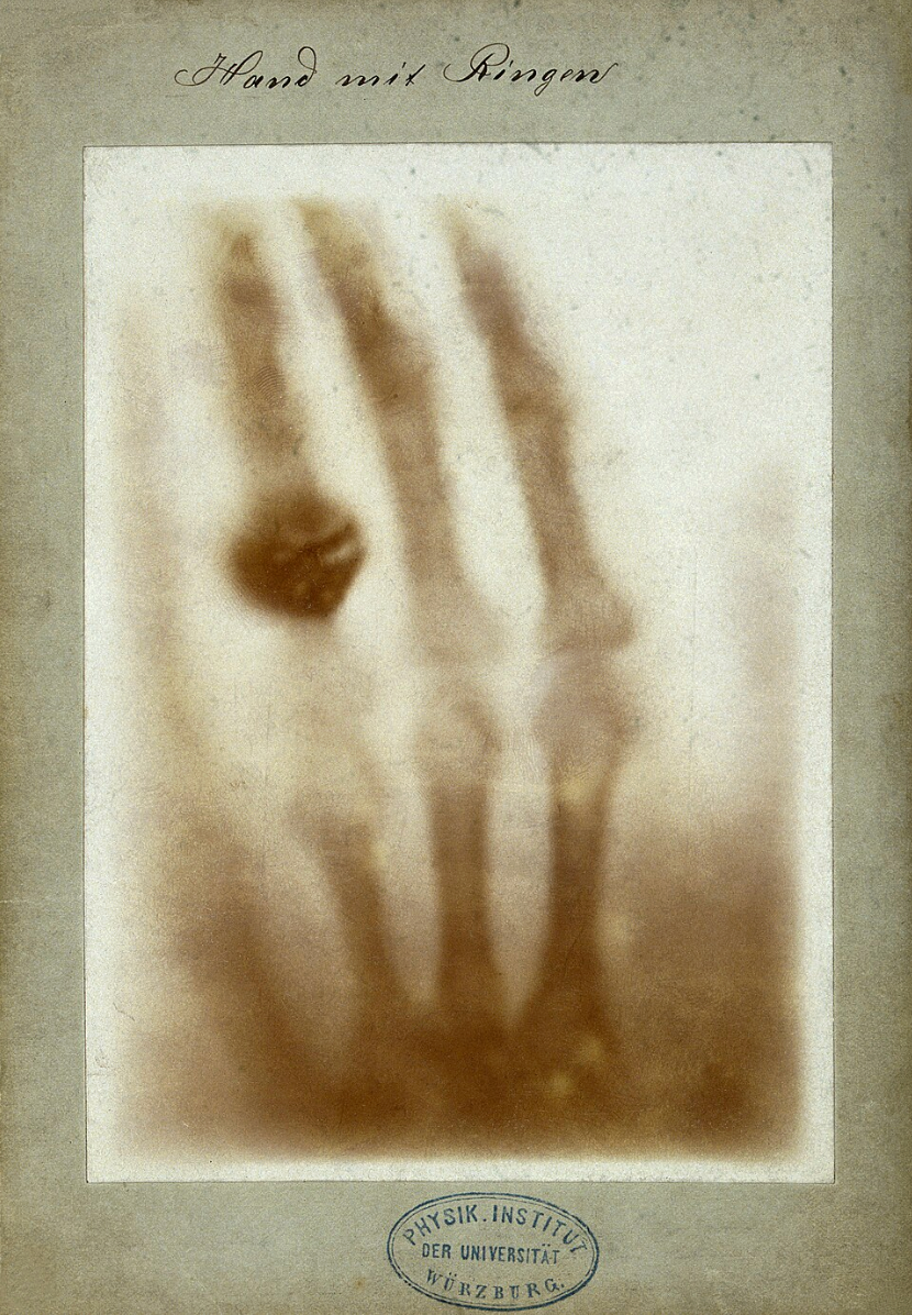Homeopathic X-Ray: How to Support Your Body Through Ionising Radiation